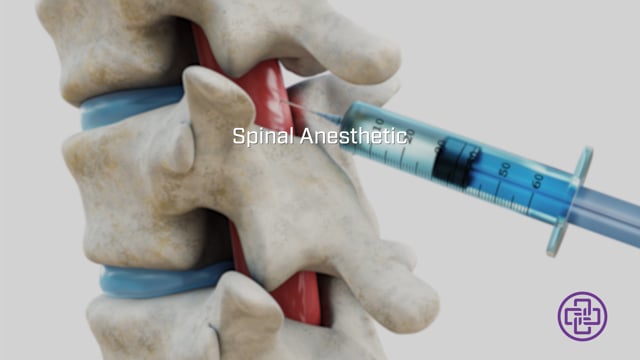 Anesthesia Thumbnail